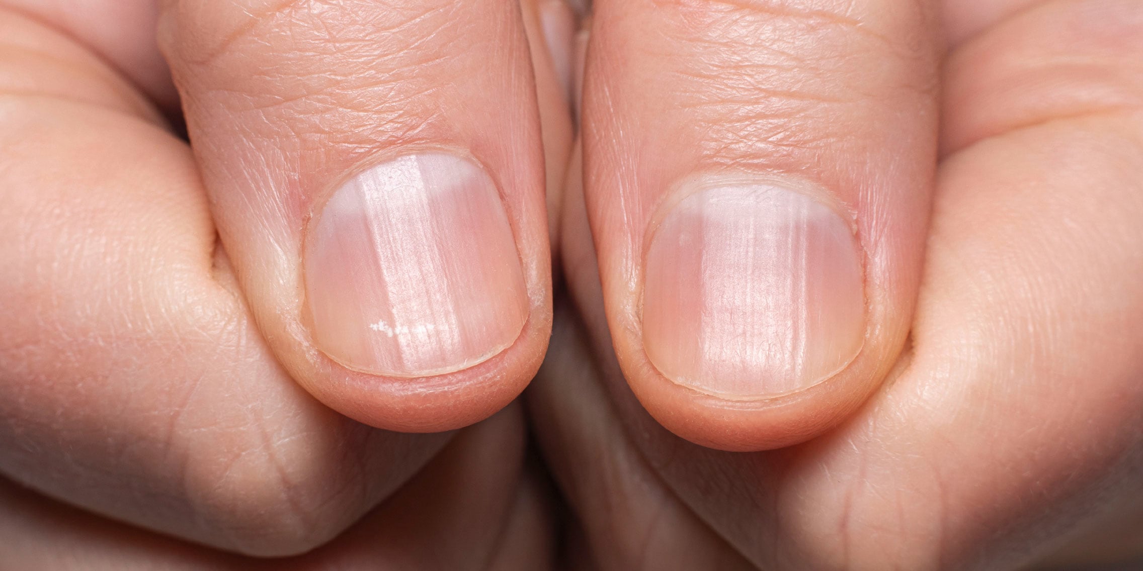 Why do we have white half-moons under our fingernails? - Galaxus