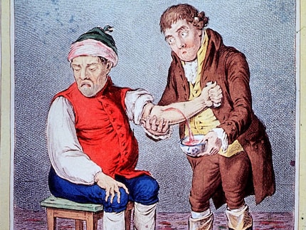 La saignée au Moyen Âge. Photo : history.com