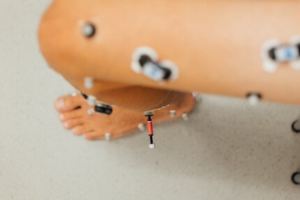 «Antennas» on the leg: I'm not being remote-controlled, I'm being analysed.
