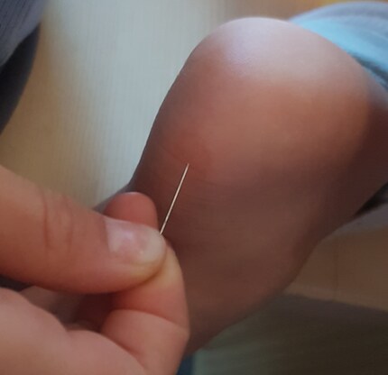 Percer l’ampoule, un petit pansement, et c’est reparti.