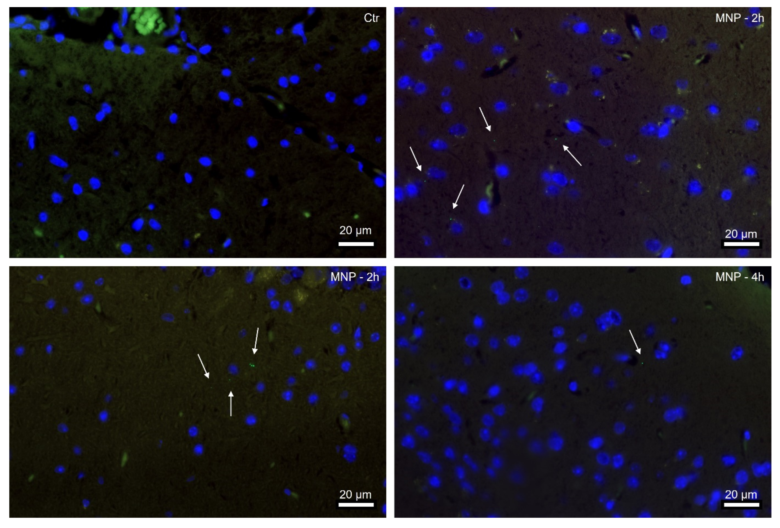 Deux heures seulement après avoir été ingérées, les nanoparticules marquées par des marqueurs fluorescents verts étaient visibles dans le cerveau des souris. 