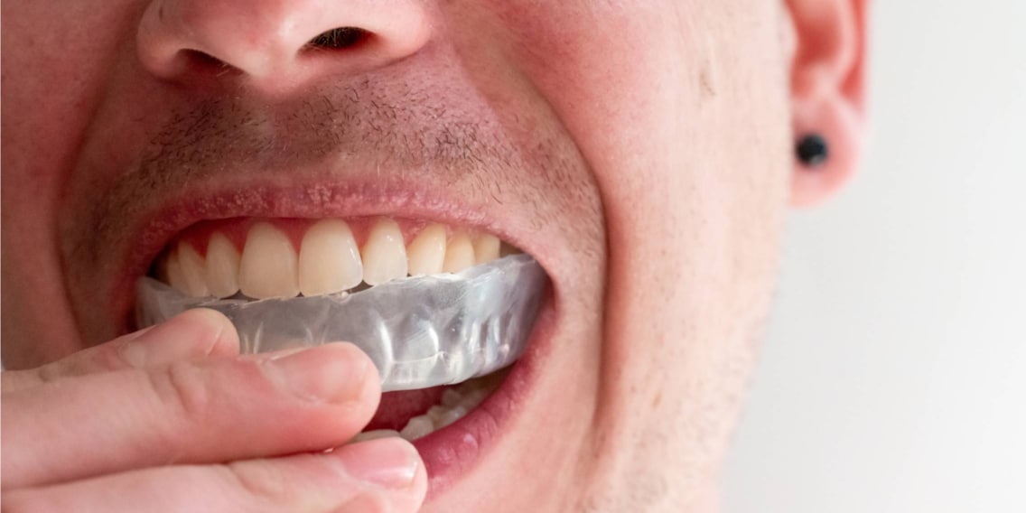 Healthy teeth: expert tips from a dentist