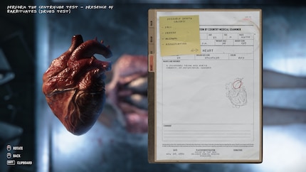 Vous en apprendrez plus sur Jack et son passé en autopsiant les corps. 
