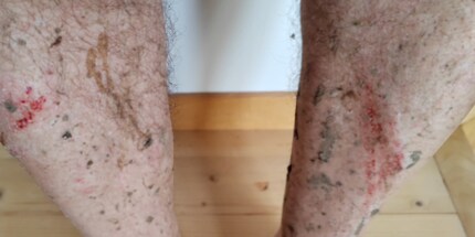 Je suis maltraité par mes propres pédales.