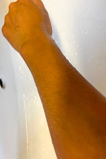 ..et les tatouages sont complètement effacés.